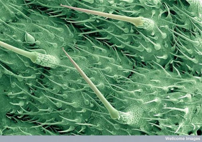 Brûlure des feuilles d'ortie - Choses courantes au microscope: que cachent-elles? Жгучие волоски листьев крапивы - Обычные вещи под микроскопом