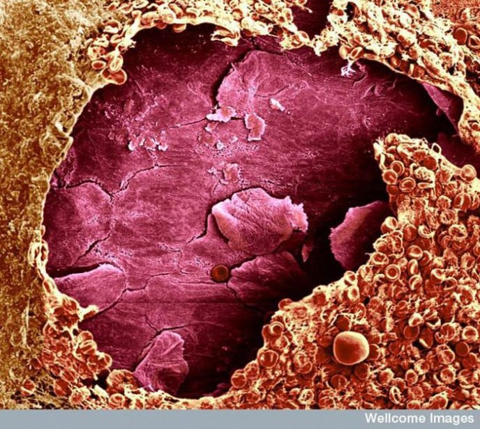 - Les choses communes au microscope: que cachent-elles? - Обычные вещи под микроскопом
