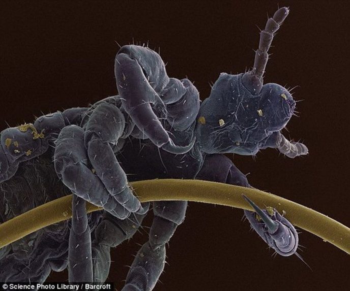 - Les choses communes au microscope: que cachent-elles? - Обычные вещи под микроскопом