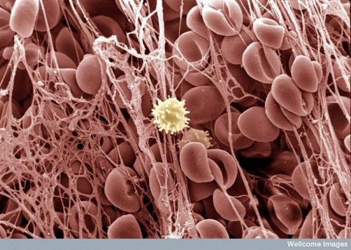 Caillot de sang - Des choses communes sous un microscope: que cachent-ils? Сгусток крови - Обычные вещи под микроскопом
