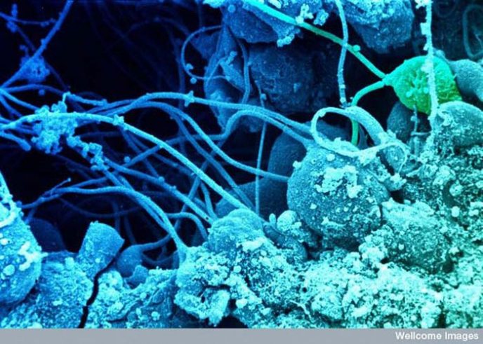 Les spermatozoïdes se développent dans les testicules - Les choses communes au microscope: que cachent-elles? Сперматозоиды развиваются в семенниках - Обычные вещи под микроскопом