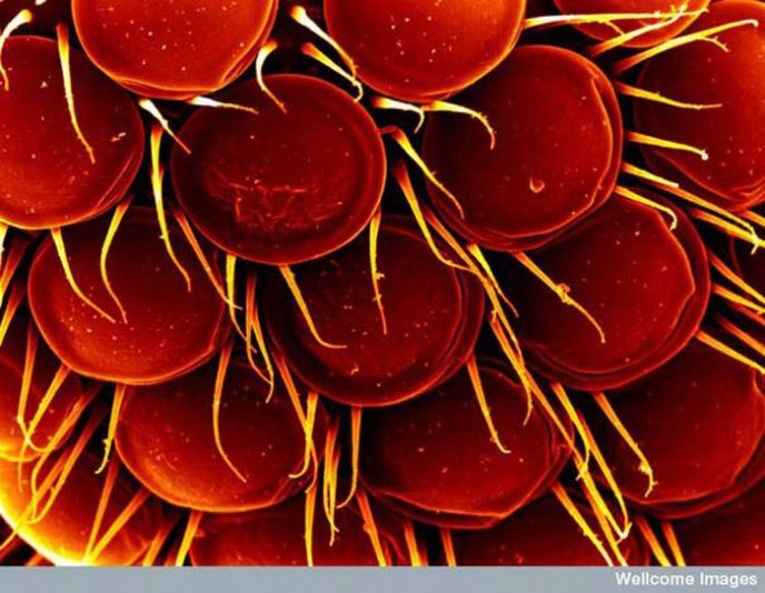 Oeil des moucherons - Des choses communes au microscope: que cachent-ils? Глаз мошки - Обычные вещи под микроскопом