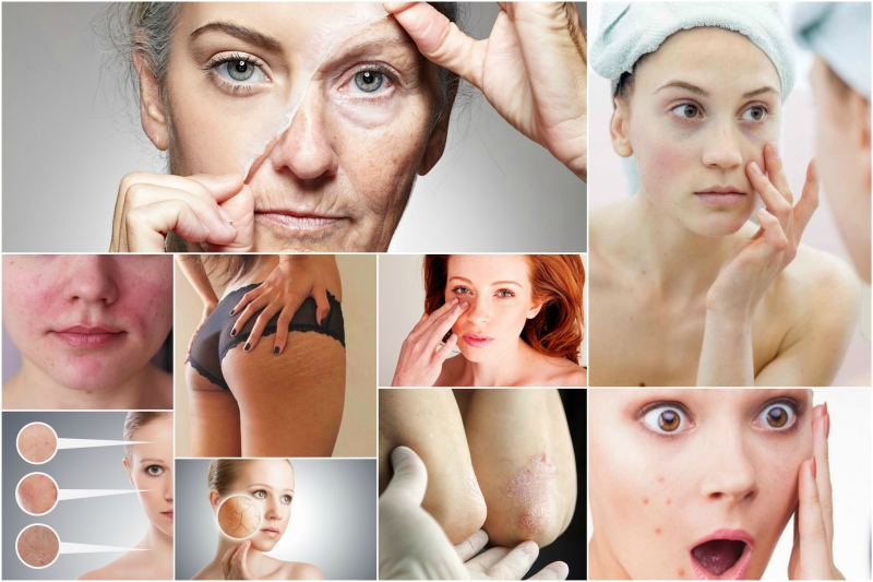 De quoi votre peau essaie-t-elle de vous avertir: les signes les plus courants О чём пытается предупредить вас ваша кожа