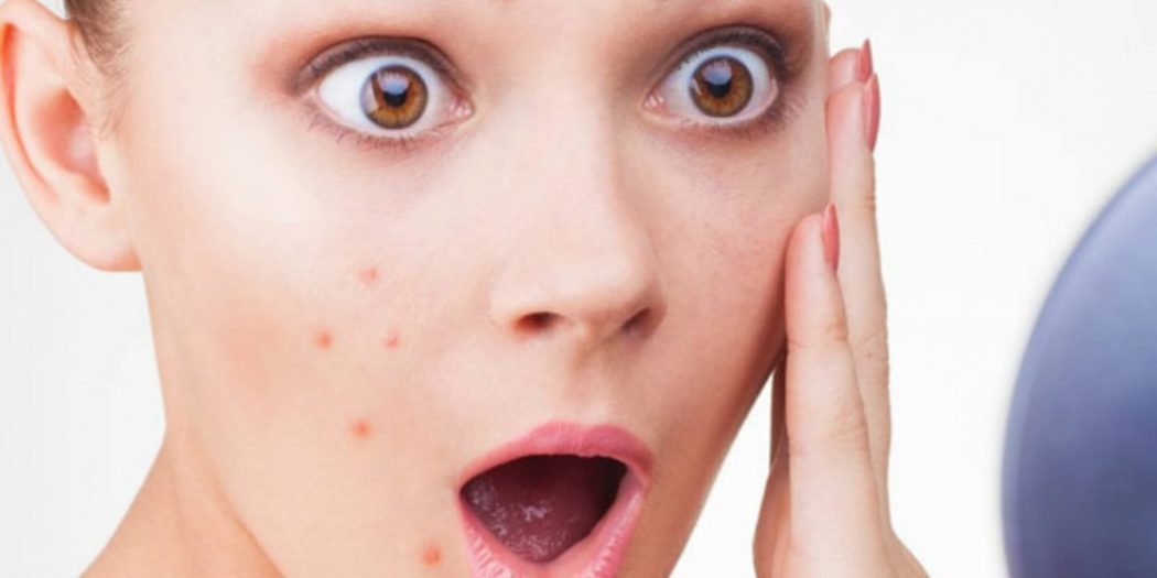 De quoi votre peau essaie-t-elle de vous avertir: les signes les plus courants О чём пытается предупредить вас ваша кожа