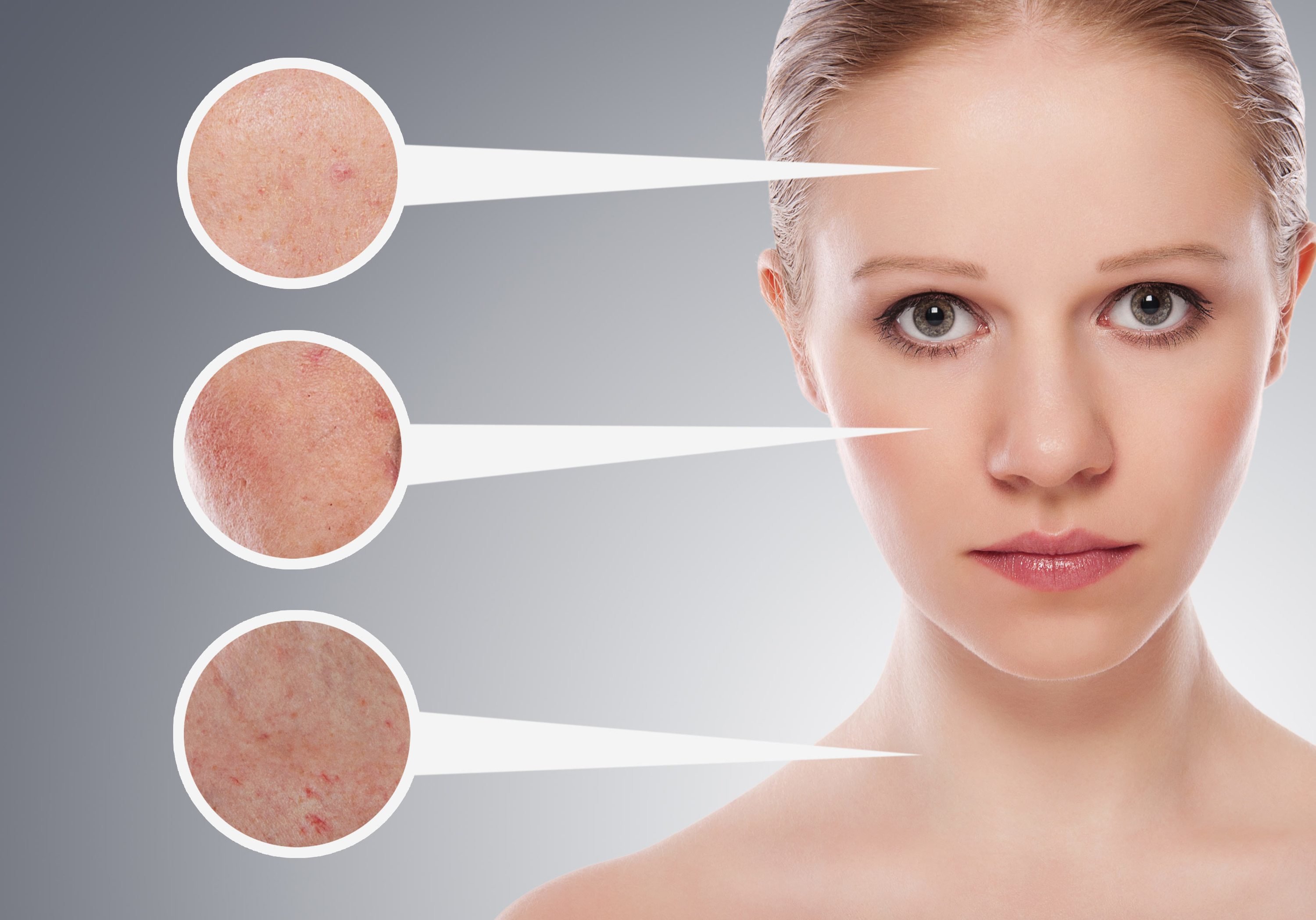 De quoi votre peau essaie-t-elle de vous avertir: les signes les plus courants О чём пытается предупредить вас ваша кожа