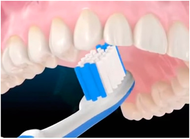 Règles pour le soin des dents Ошибки при чистке зубов