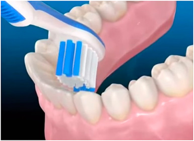 Règles pour le soin des dents Ошибки при чистке зубов