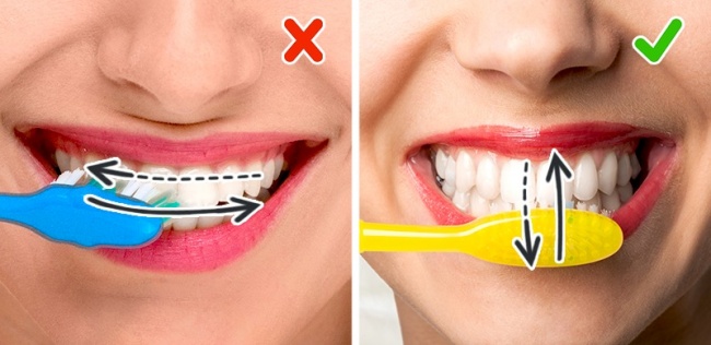 Règles pour le soin des dents Ошибки при чистке зубов