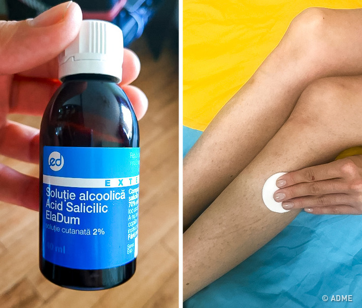Acide salicylique - Les médicaments à prix abordable de la pharmacie, qui ne font pas pire que les cosmétiques coûteux Салициловая кислота - Бюджетные средства из аптеки, не хуже дорогой косметики
