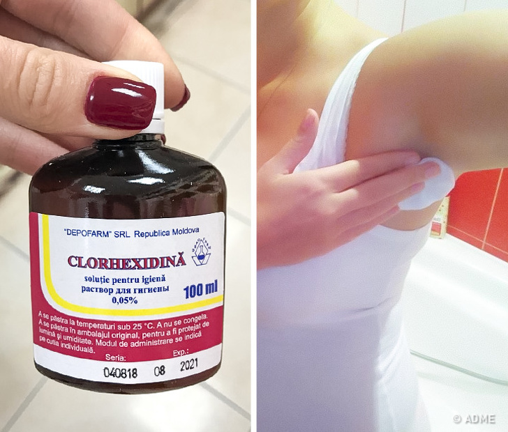 Chlorhexidine - Médicaments abordables de la pharmacie, qui ne font pas de mal aux cosmétiques coûteux Хлоргексидин - Бюджетные средства из аптеки, не хуже дорогой косметики