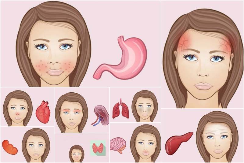 - Les changements dans le visage sont des signes de processus indésirables dans le corps. - Изменения на лице