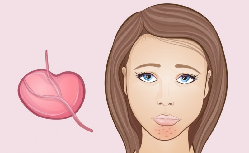 Menton - Les changements dans le visage sont des signes de processus corporels indésirables. Подбородок - Изменения на лице