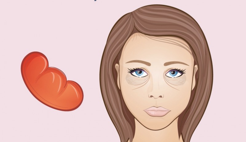 Cercles sous les yeux - Les changements sur le visage sont des signes de processus indésirables dans le corps. Круги под глазами - Изменения на лице