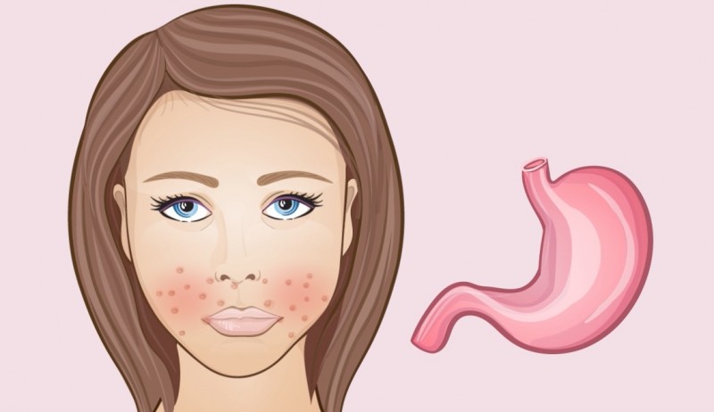 La partie inférieure des joues - Les changements dans le visage sont des signes de processus indésirables dans le corps Нижняя часть щек - Изменения на лице
