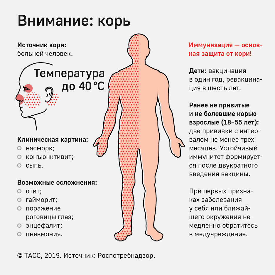 Quelle est la différence entre la varicelle et la rougeole et la scarlatine de la rubéole? Корь, скарлатина, краснуха