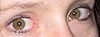 yeux Ambre - Types de couleurs des yeux
