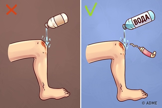 Techniques de premiers secours connues que 90% des gens font mal Ошибки первой помощи