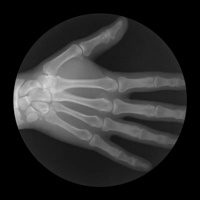 Рентген руки, сжимающейся в кулак Удивительные гифки, показывающие, как работает наше тело