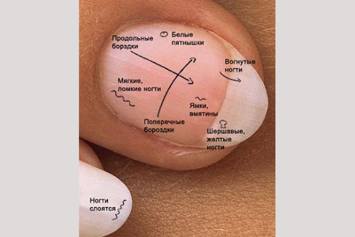 Des secrets que vos ongles peuvent dire Ногти и здоровье
