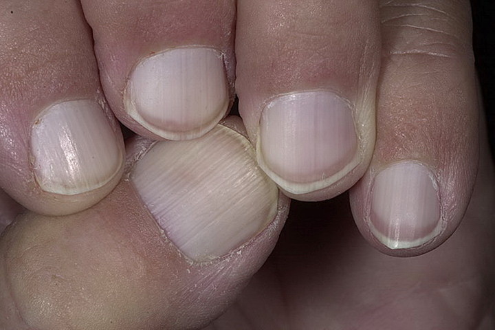 Ongles blancs à rayures roses Белые ногти с розовыми полосками