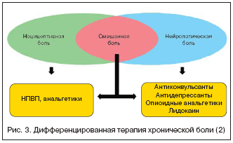 Douleur neuropathique Нейропатическая боль