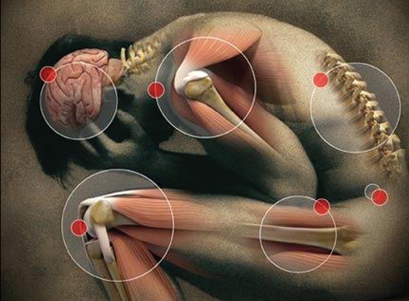 Douleur neuropathique Нейропатическая боль