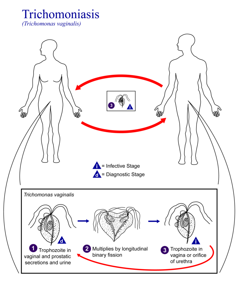 Trichomonase 01 Trichomoniasis 01