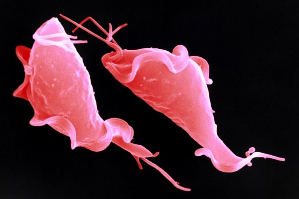 Trichomonas Infection parasitaire insidieuse qui envahit la population Трихомонада