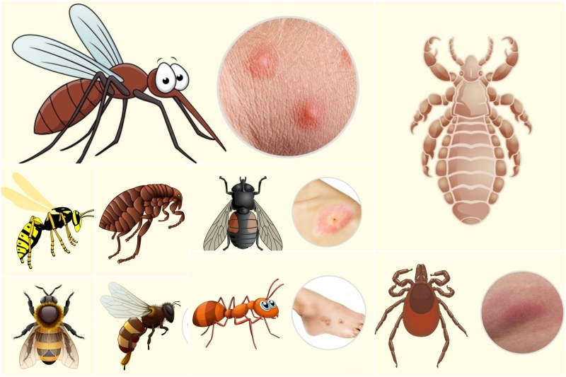 - Comment reconnaître exactement quel insecte vous a mordu - Чей это укус?