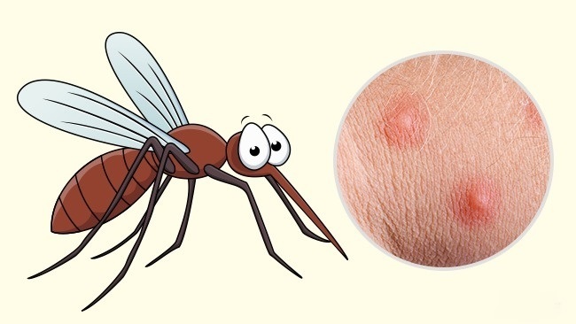 Mosquito - Comment reconnaître exactement quel insecte vous a mordu Комар - Чей это укус?