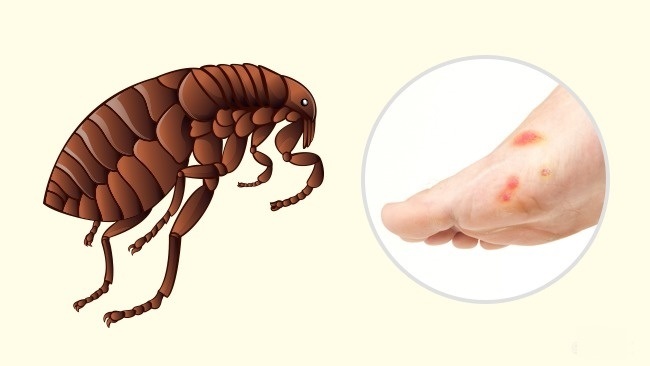 Les puces - Comment reconnaître exactement quel insecte vous a mordu Блохи - Чей это укус?