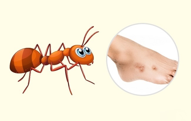 Ant - Comment reconnaître exactement quel insecte vous a mordu Муравей - Чей это укус?
