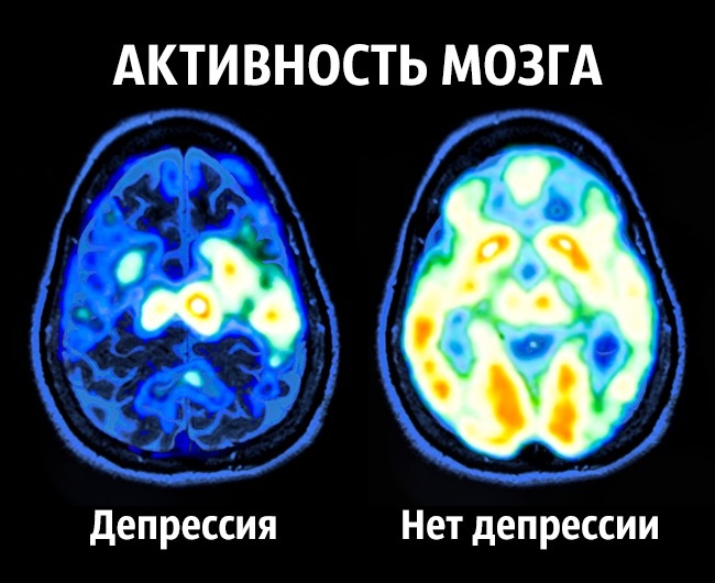 Conseils du neurobiologiste pour devenir heureux une fois pour toutes Как стать счастливым