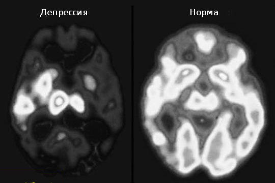 Tout ce que l'âme expérimente, le corps le rend visible Что переживает Душа, Тело делает видимым