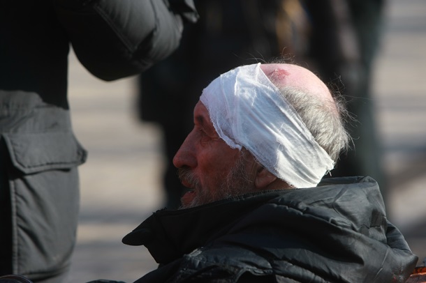 manifestants blessés et blessés Пострадавшие и раненные митингующие