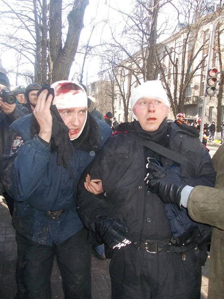 Capturé et MUP blessés Захваченные и раненные сотрудники МВД