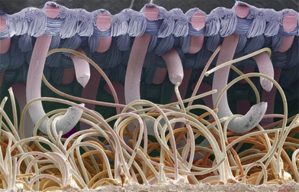 Château-agrippante - Photos 30+ sous le microscope Замок-липучка - 30+ Фотографий под Микроскопом