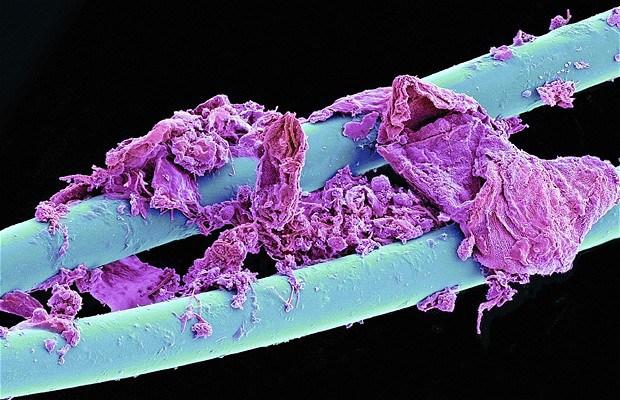 Floss - Photos 30+ sous le microscope Использованная зубная нить - 30+ Фотографий под Микроскопом