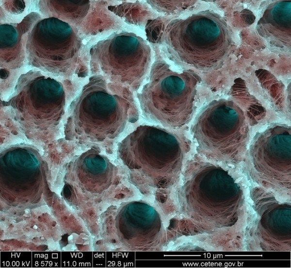La structure de la dent humaine - Photos 30+ sous le microscope Структура человеческого зуба - 30+ Фотографий под Микроскопом
