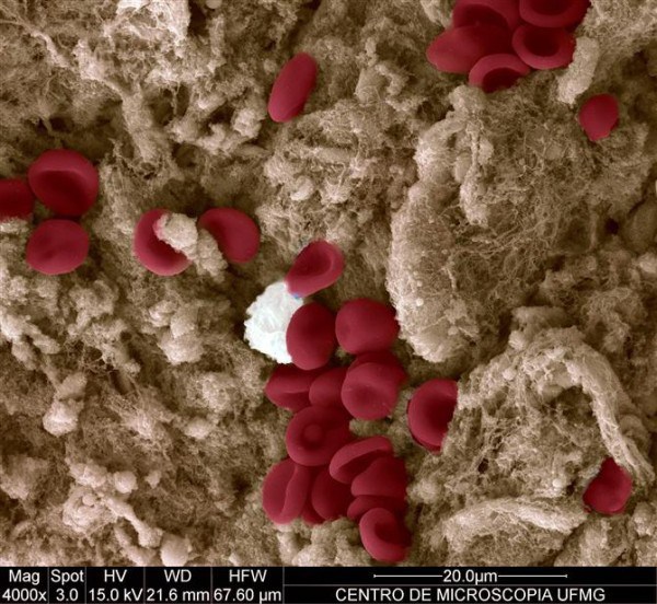 Les particules de sang sur la coupe - Photos 30+ sous le microscope Частички крови на порезе - 30+ Фотографий под Микроскопом