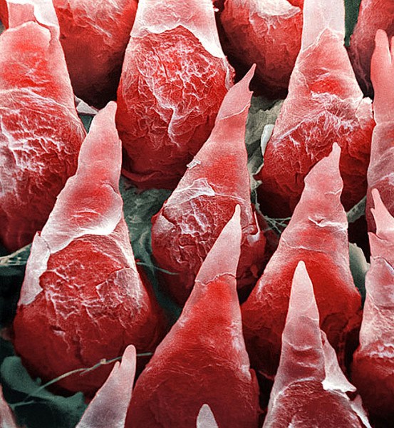 La surface de la langue - Photos 30+ sous le microscope Поверхность языка - 30+ Фотографий под Микроскопом