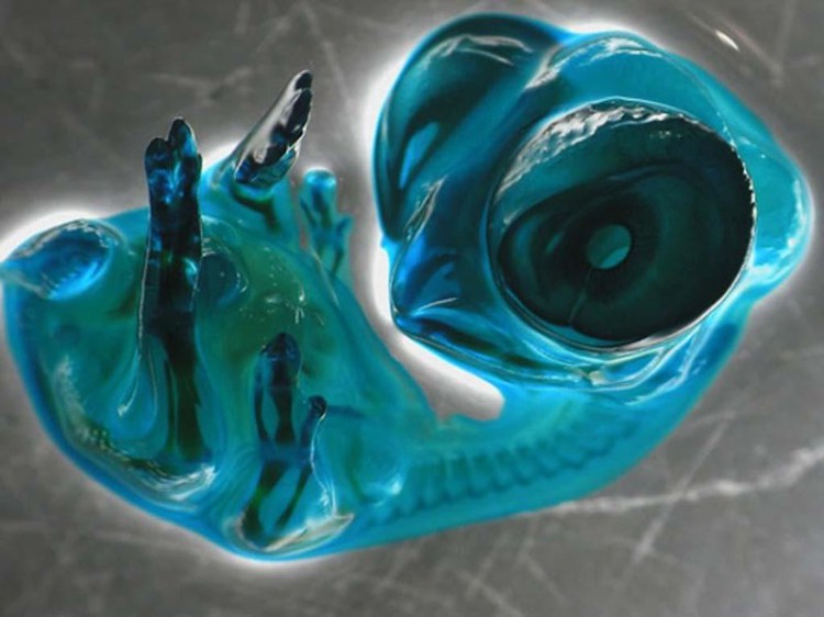 Chicken Embryo - Photos 30+ sous le microscope Эмбрион курицы - 30+ Фотографий под Микроскопом