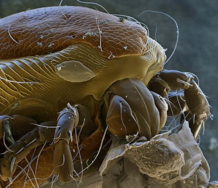 Tiques - 30+ Photos sous le microscope Клещь - 30+ Фотографий под Микроскопом