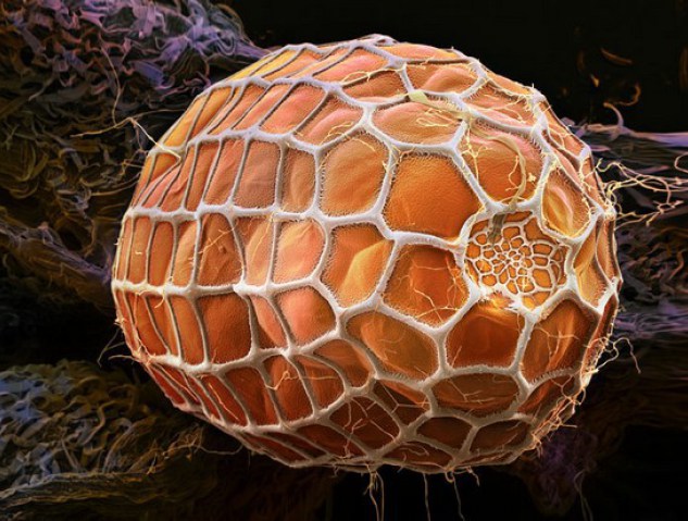 Egg-white-tip butterfly zebra - Photos 30+ sous le microscope Яйцо длиннокрылой бабочки-зебры - 30+ Фотографий под Микроскопом