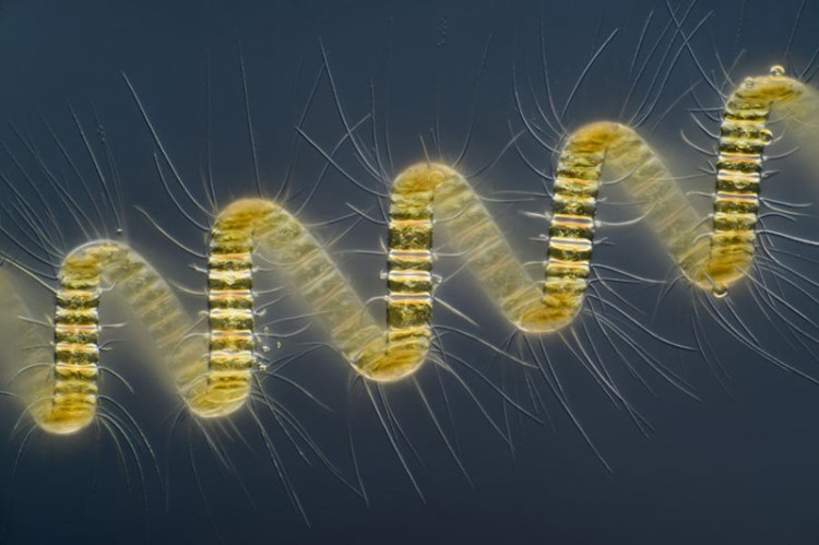 Colonial organisme planctonique - Chaetoceros debilis - 30+ Photos sous le microscope Колониальный организм планктона — Chaetoceros debilis - 30+ Фотографий под Микроскопом