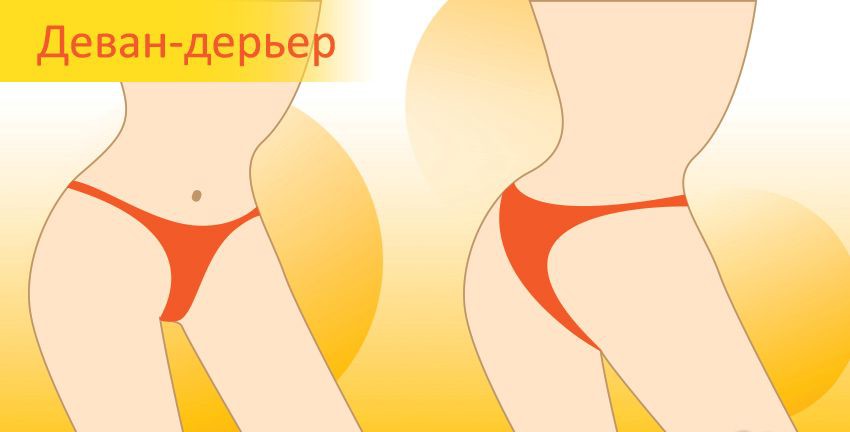 Dewan-Derer - Types de culottes pour femmes Деван-дерьер - Виды женских трусиков
