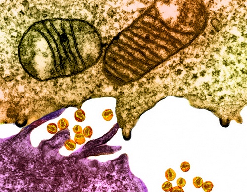 ВИЧ между эпителиальной клеткой (снизу) и лимфоцитом (сверху) (фото Visuals Unlimited / Corbis).