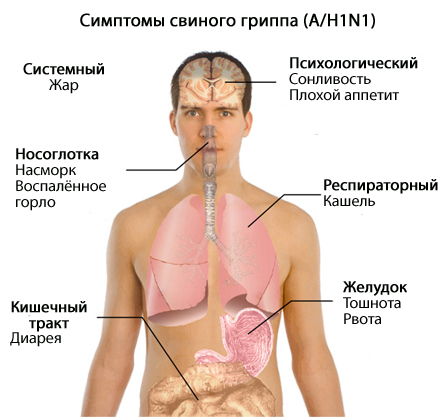 Liste de contrôle pour l'influenza de type A / H1N1