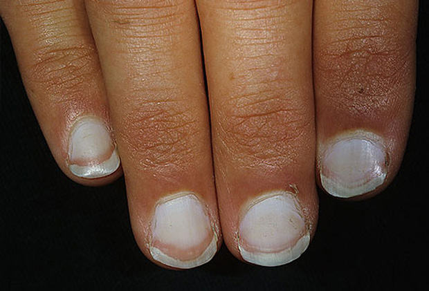 Nails et votre santé Ногти и ваше здоровье