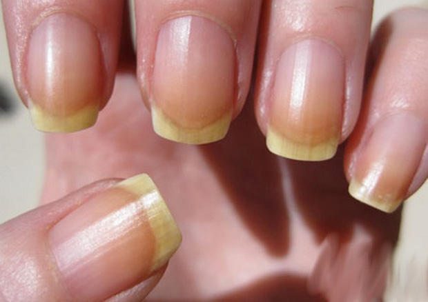 Nails et votre santé Ногти и ваше здоровье